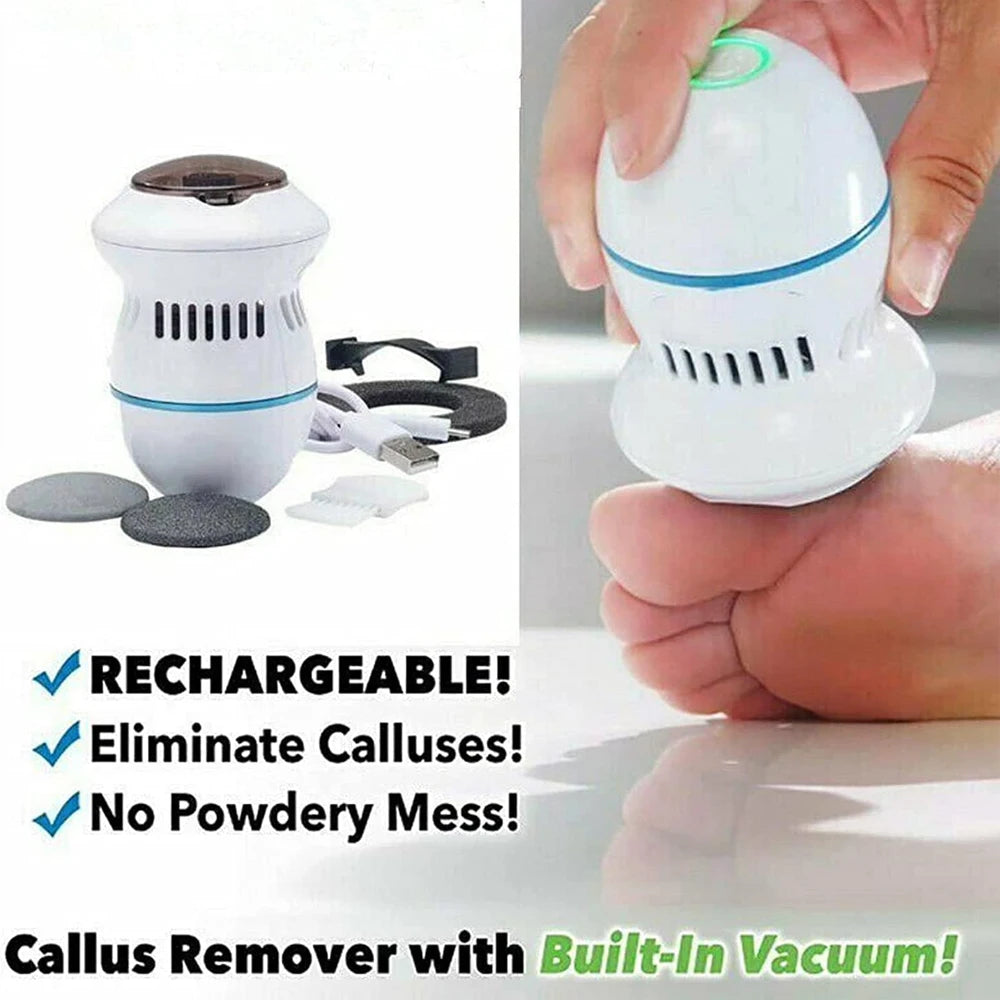 SmoothSole Electric Foot File: Callus Remover for Silky Soft Feet