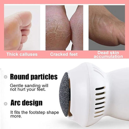 SmoothSole Electric Foot File: Callus Remover for Silky Soft Feet